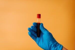 FDA одобрило анализ крови для диагностики болезни Альцгеймера